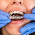 Embrace the Invisible: Unveiling the Power of Invisalign Dentist