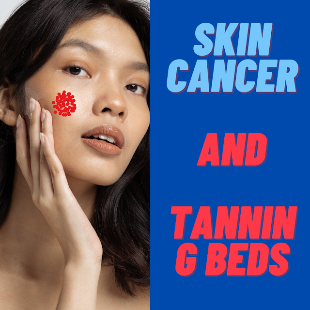 Skin Cancer and Tanning Beds
