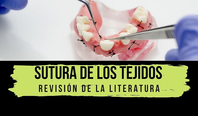 PDF: Sutura de los tejidos en Cirugía Bucal: Revisión de la literatura