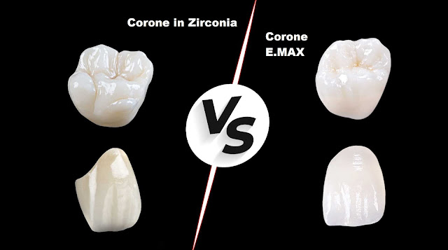 Corone in Zirconia e Corone E.MAX