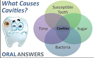 The Causes Of Cavities