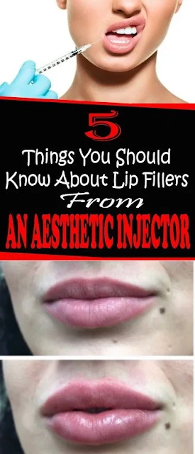 5 Things You Should Know About Lip Fillers From An Aesthetic Injector