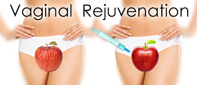 vaginal rejuvenation malaysia