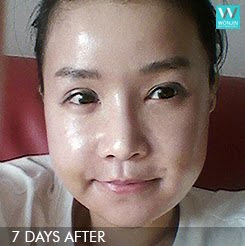 짱이뻐! - Korean Best Face Contouring For The New Me