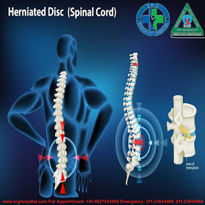 Spine Specialist In New Delhi