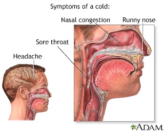 Flu