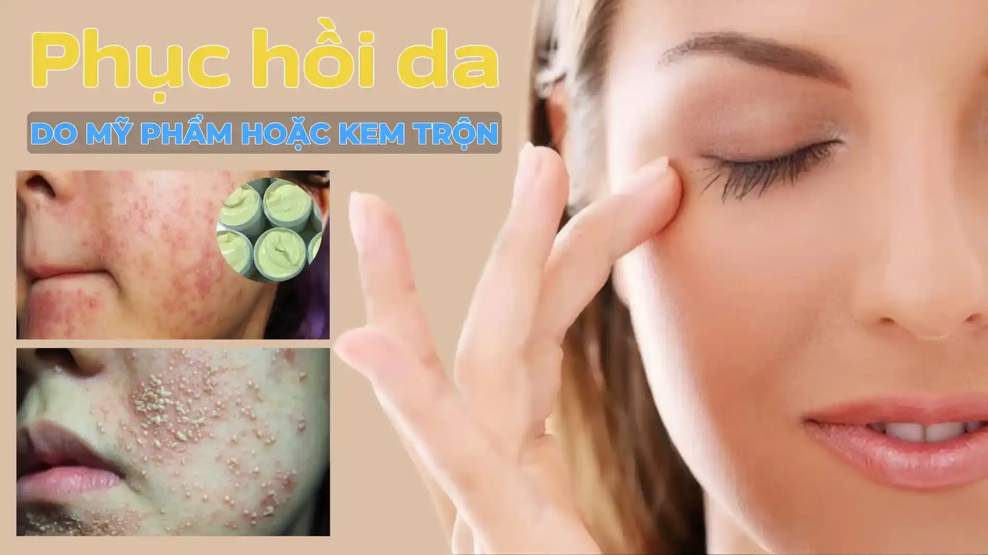 cach-phuc-hoi-da-sau-ton-thuong-do-my-pham-hoac-kem-tron