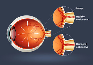 optometry journal articles