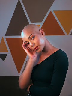 Hal yang Harus Dihindari Saat Anda Mengalami Alopecia Areata