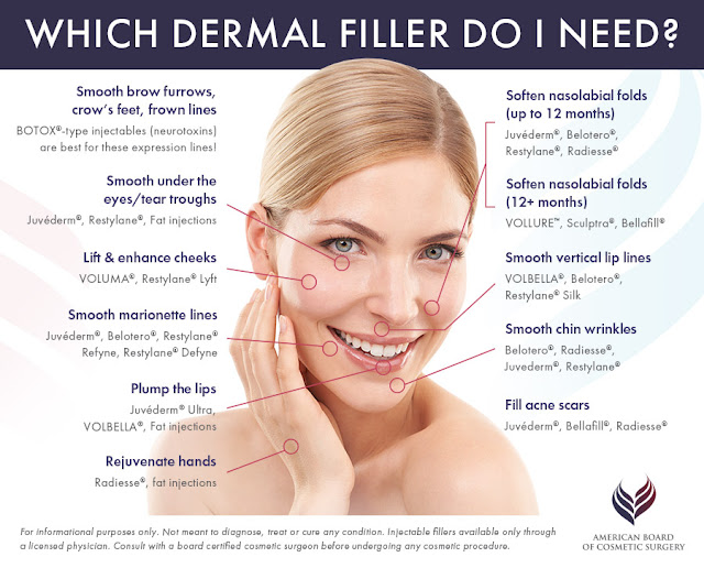 dermal filler malaysia