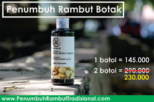 obat penyubur rambut botak manjur dan ampuh ratu kemiri