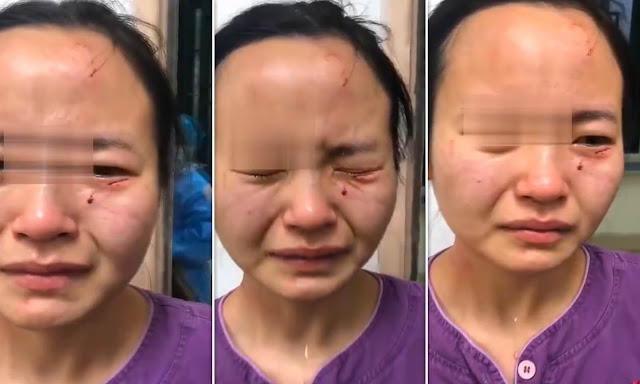 Nigerian coronavirus patient in China bites nurse’s face after failed attempt to escape quarantine 
