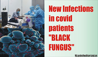 New Infections in covid patients "BLACK FUNGUS"