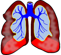 Comment vivre avec votre asthme