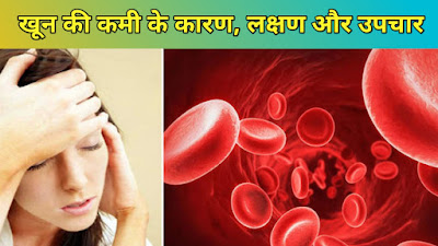 Anemia - एनीमिया ( खून की कमी ) के कारण, लक्षण, रोकथाम और इलाज