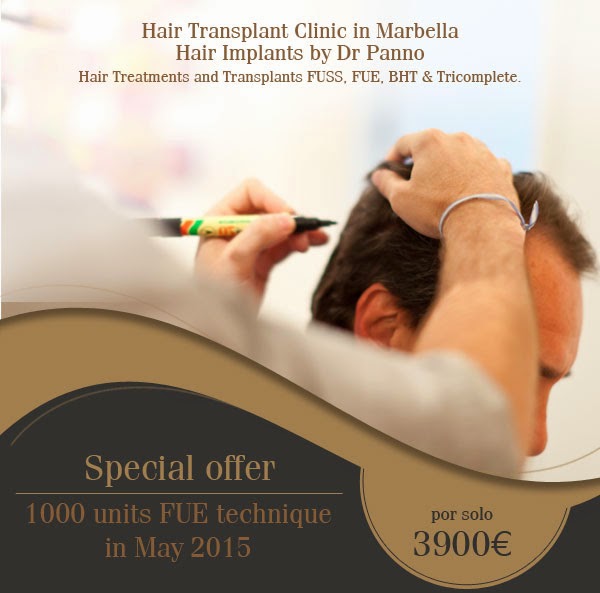 special-offer-hair-transplant-fue-technique-may