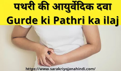 Gurde ki Pathri ka ilaj