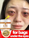Dark circles cream and eye bags removal puffiness away work under eyes