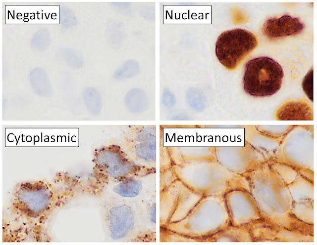 Immunohistochemistry Market