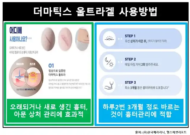 더마틱스울트라겔-사용방법