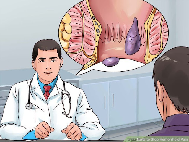 How do you treat hemorrhoids