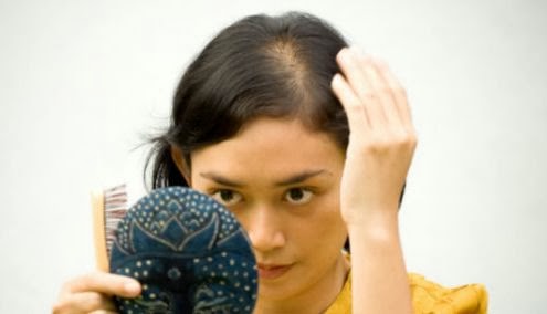 Tips Menumbuhkan Rambut Rontok Secara Alami Dengan Cepat