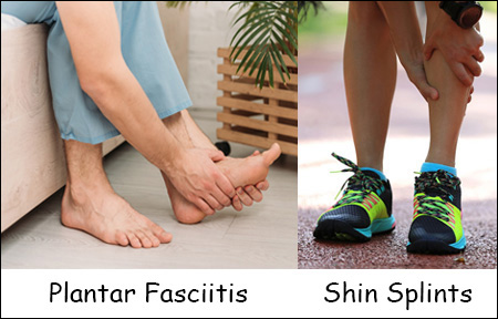 Plantar Fasciitis, Shin Splints