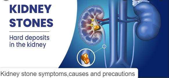 Kidney stone symptoms,causes and precautions