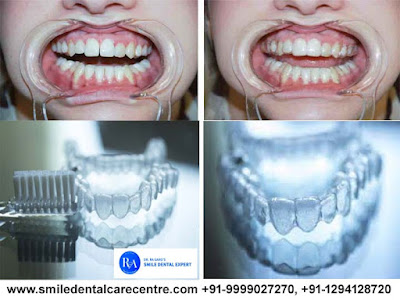 Best Dental Clinic in Faridabad