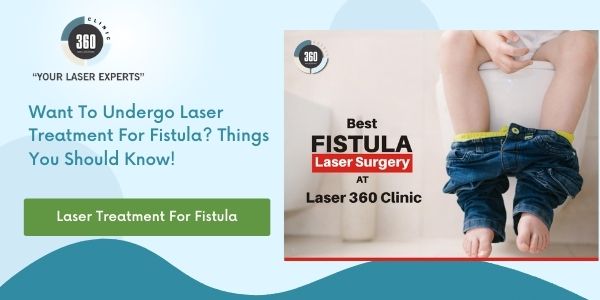 Laser Fistula Treatment In NCR