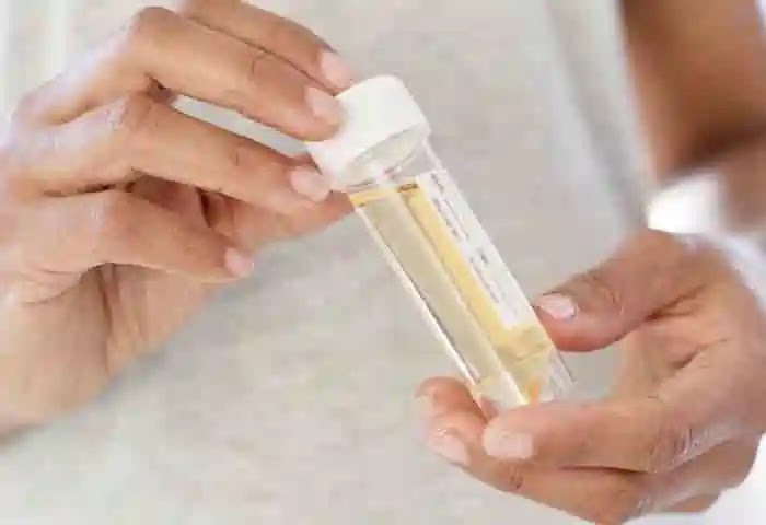 News, National, New Delhi, Foods, Health, Lifestyle, Diseases, what causes smmelly Urine?