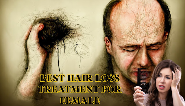 Best hair loss treatment for female