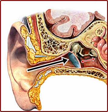 SNHL,Sensorineural hearing loss,Conductive hearing loss, CHL, Ear anatomy