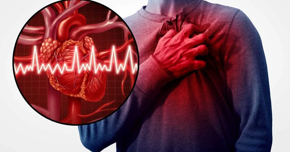 صورة توضيحية تشير إلى أمراض القلب، تعرض تشريح القلب مع توضيح للمنطقة المصابة مثل انسداد الشرايين أو الأوعية الدموية. تساعد الصورة في فهم الأعراض والتشخيص المتعلق بمشاكل القلب