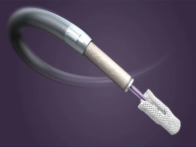 TriClip™ Transcatheter Tricuspid Valve Repair System - TechSci Research