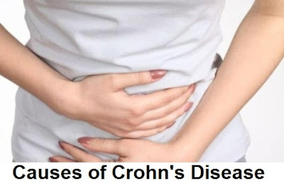 crohn's disease information: systems of crohn's disease