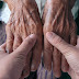 Parkinson: Diagnóstico precoce facilita um melhor tratamento da doença