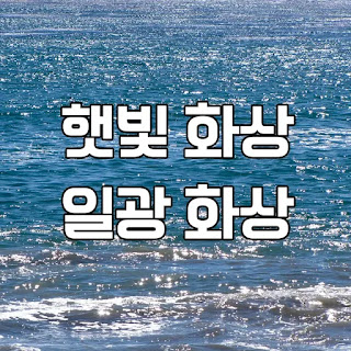 햇빛 화상 일광화상 썸네일