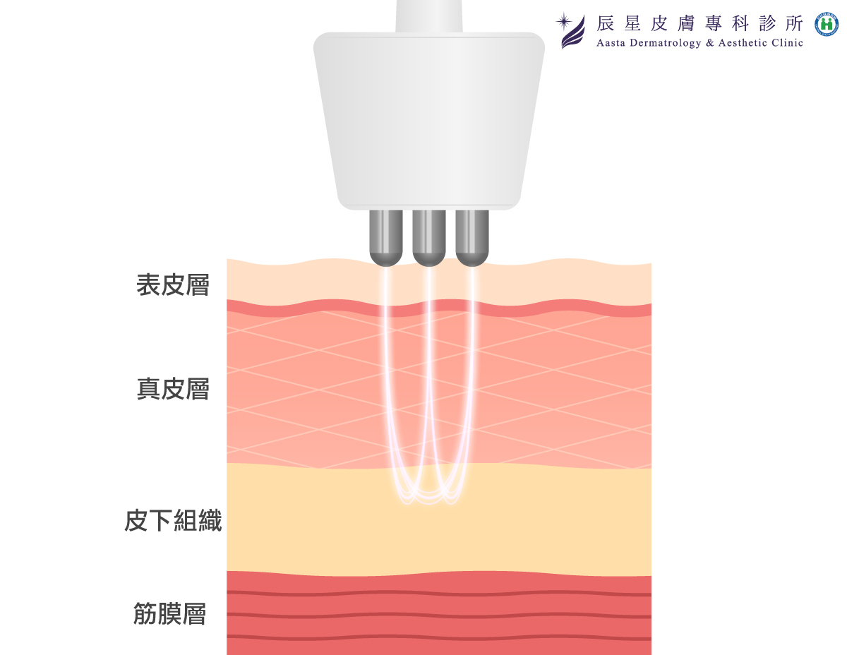 三極電波