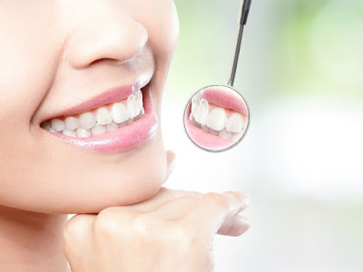 Bọc răng sứ khi bị móm là gì?