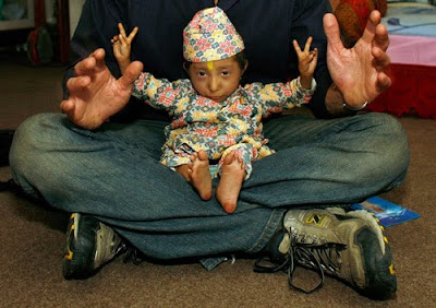 world's shortest man