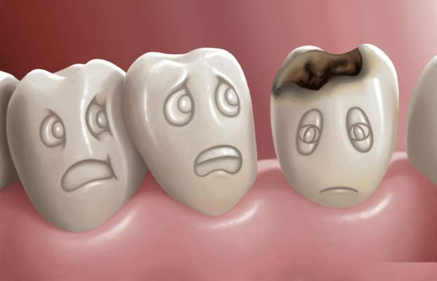 Penyebab Sakit Gigi yang Perlu Kita Ketahui