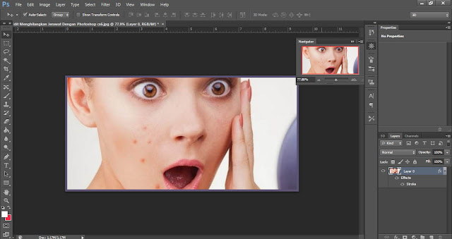 Cara Edit Menghilangkan Jerawat Dengan Photoshop cs6