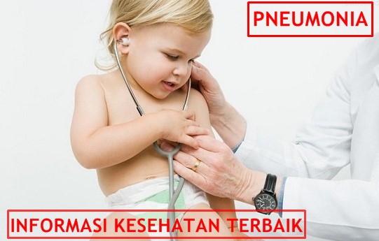 Pengobatan Pneumonia Pada Anak dan Bayi Tradisional