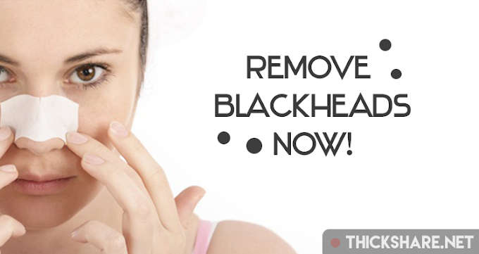 14 Ways To Get Rid Of Blackheads On Nose Instantly