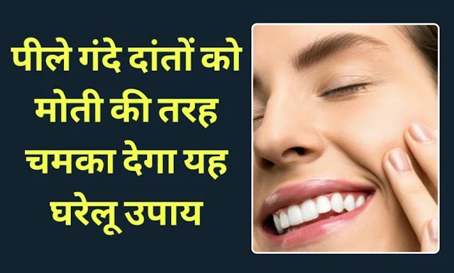 Teeth whitening tips in Hindi