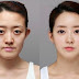 Tìm hiểu về phương pháp gọt cằm