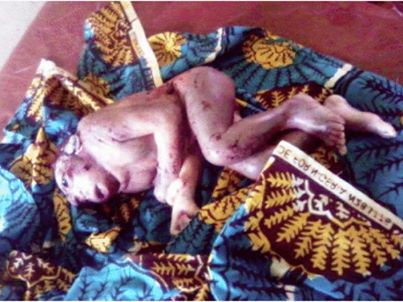 Photo: Woman Gives Birth To A Baby Monkey In Kaduna