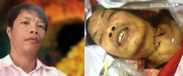 Image result for Hải ngoại TỨC TỐC đưa ra Quốc tế vụ anh Tấn PGHH bị cắt cổ CHẾT trong đồn công an vì "cờ vàng"