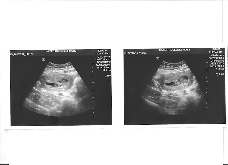 11 weeks pregnant. 9 weeks pregnant.